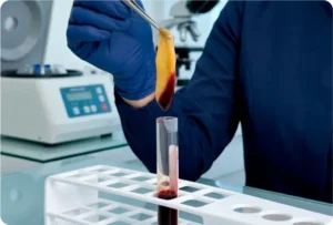 Cicatriprime-Centro-Integrado-de-Feridas-Complexas-e-Medicina-Regenerativa-tecnologias-e-diferenciais-terapias-regenerativas